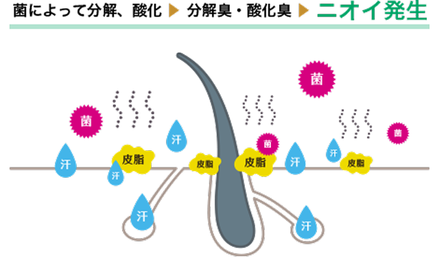 頭皮のニオイの原因